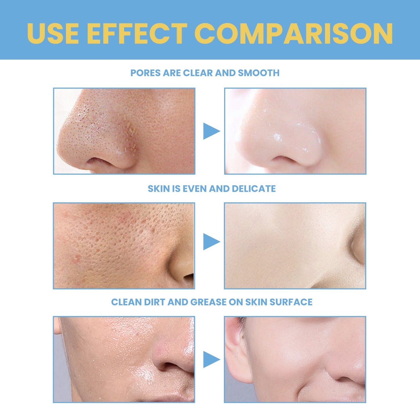 Eelhoe Face And Body Whitening Cream