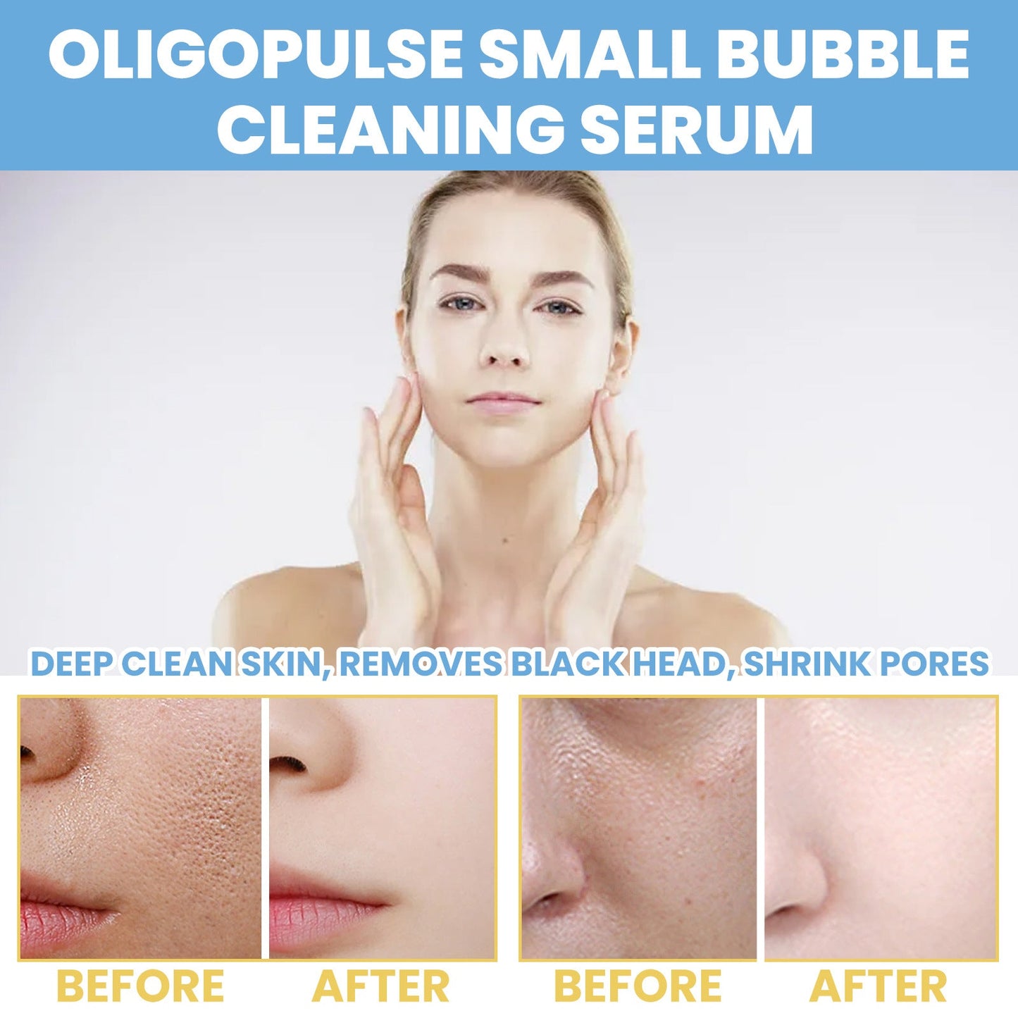 Eelhoe Face And Body Whitening Cream