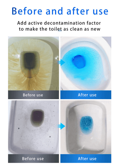 🔥 48% OFF💕SINK & DRAIN CLEANER
